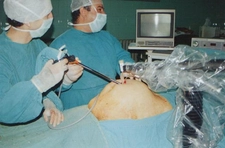 Safra Kesesi Kisti Belirtileri ve Tedavisi