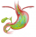 Safra Sıvısı Özellikleri ve Faydaları Nelerdir?